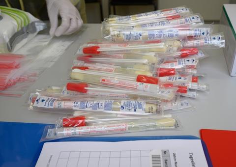 SP tem fila de 12 mil exames para detectar coronavírus