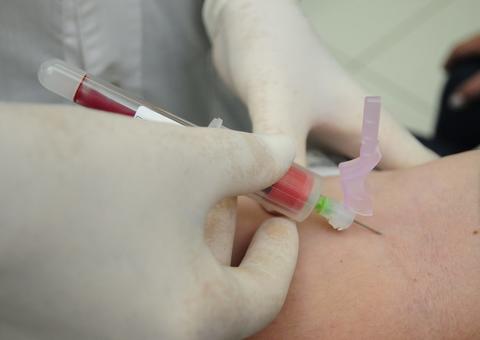 Mais de 120 casos suspeitos do coronavírus aguardam  resultado de exames no Amazonas 