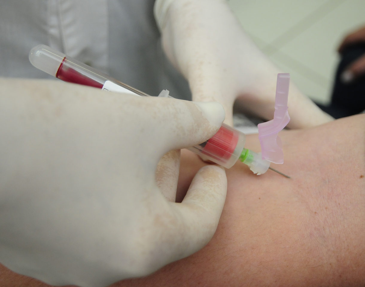 Mais de 120 casos suspeitos do coronavírus aguardam  resultado de exames no Amazonas 