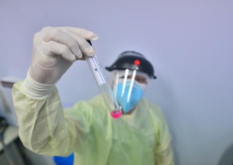 Contaminação de médicos por coronavírus é confirmada em hospitais de Manaus