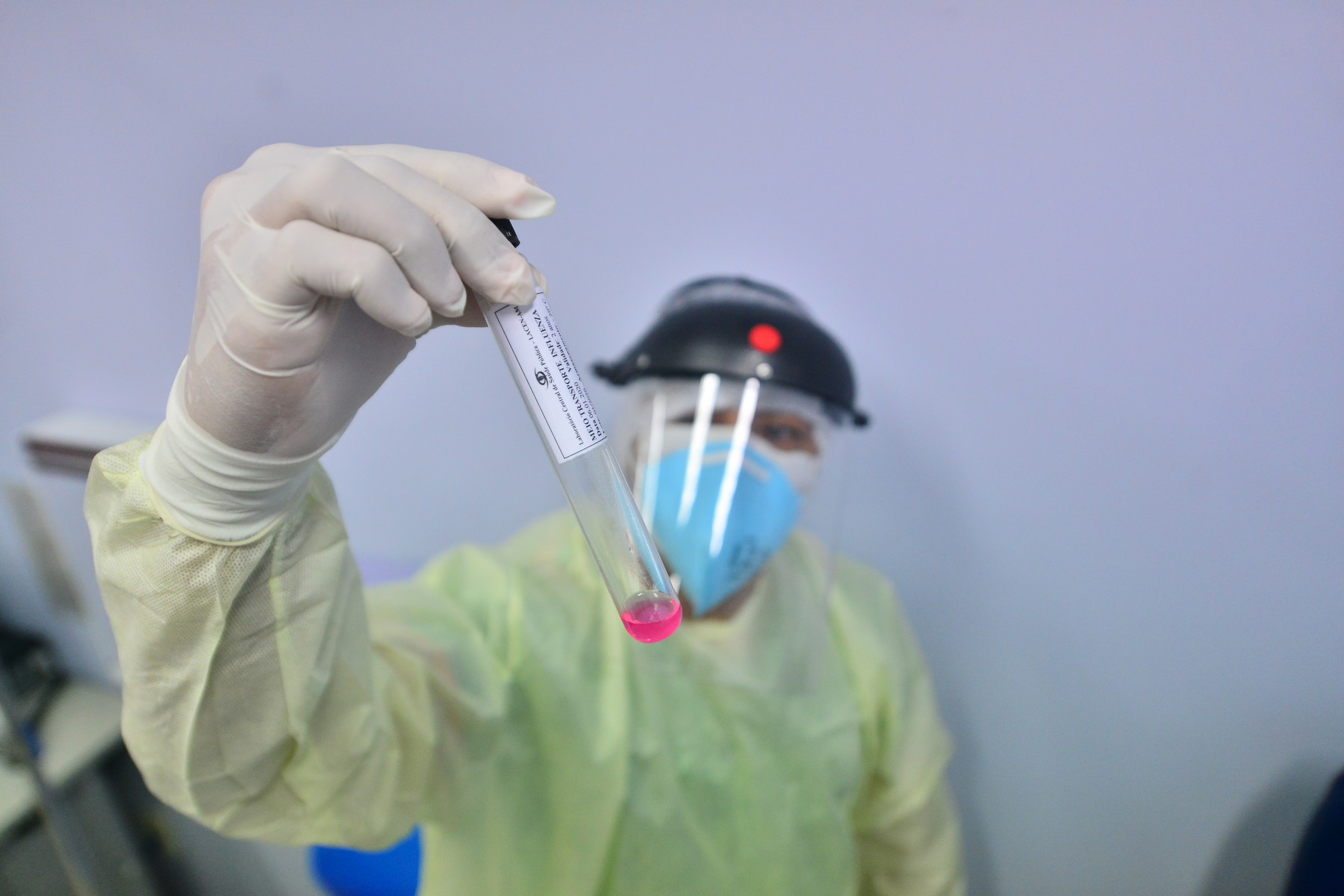 Contaminação de médicos por coronavírus é confirmada em hospitais de Manaus