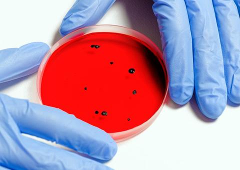 Casos de coronavírus ultrapassam 8 mil e número de mortos não para de subir no Brasil