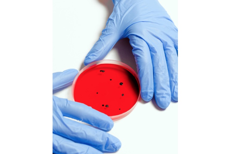 Casos de coronavírus ultrapassam 8 mil e número de mortos não para de subir no Brasil