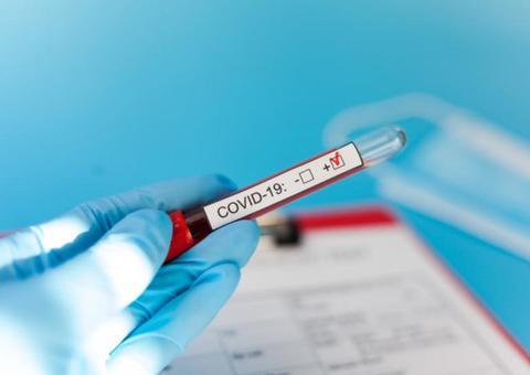 Amazonas registra 417 infectados pelo Covid-19 e número de mortes chega a 14