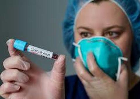 Empresa de Manaus doa EPIs para profissionais do Hospital 28 de Agosto