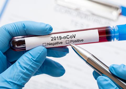 Mortes no Amazonas sobem para 23 por Covid-19