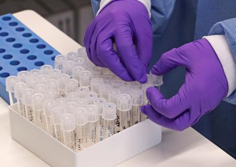 Pesquisa mapeia profissões com maior risco de contágio de coronavírus 