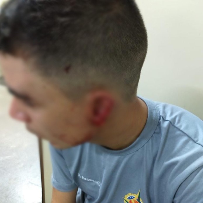 Cadeirante arranca parte da orelha de policial durante abordagem 