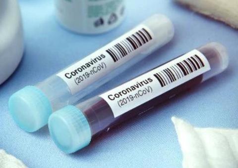 Uma pessoa com Covid-19 pode transmitir para outras 3, alerta FVS. 