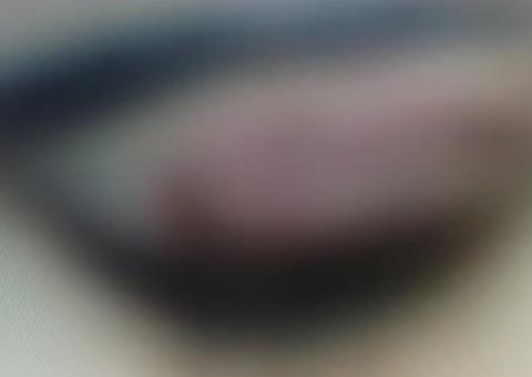 Homem é preso após morder supercílio da esposa durante briga em Manaus 