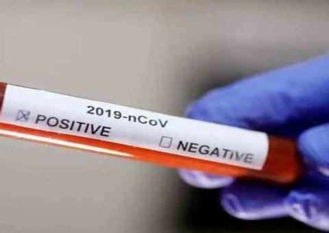 Brasil ultrapassa mil mortes por coronavírus 