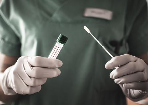 Suspeitos de furtar 15 mil testes de Covid-19 em aeroporto são presos 