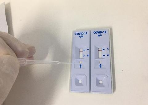 Ufam realiza testes rápidos para controle da Covid-19 em profissionais da saúde 