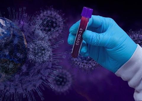 Em 2 meses, coronavírus supera número de mortes por H1N1 no Brasil