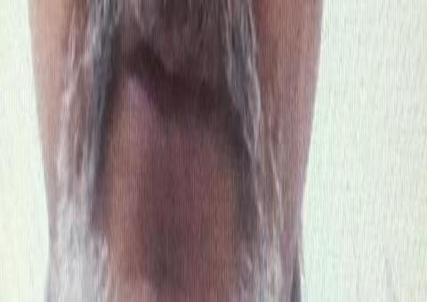 Sindicato dos médicos do Amazonas protocola pedido de impeachment de Wilson Lima