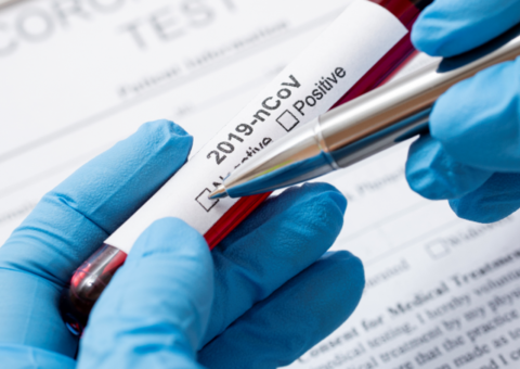 Ministério da Saúde envia mais 8 mil testes de Covid-19 para o Amazonas