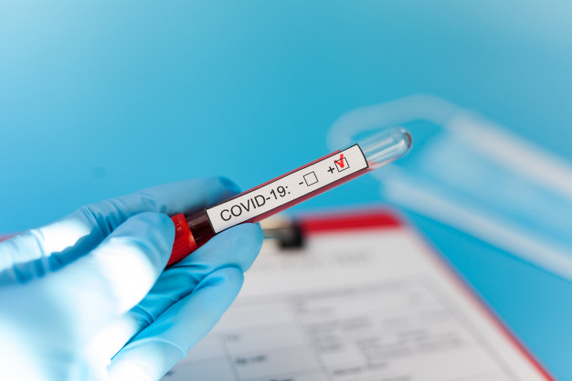 Rússia ultrapassa China em número de casos da Covid-19 e registra protestos