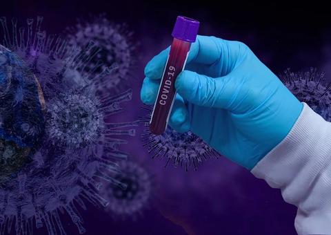 Brasil atinge a marca de 66.501 infectados e 4.543 mortes por coronavírus