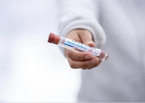 Anvisa aprova testes rápidos para covid-19 em farmácias