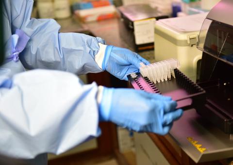 Fiocruz e Tropical passam a realizar exames de Covid-19 em Manaus 