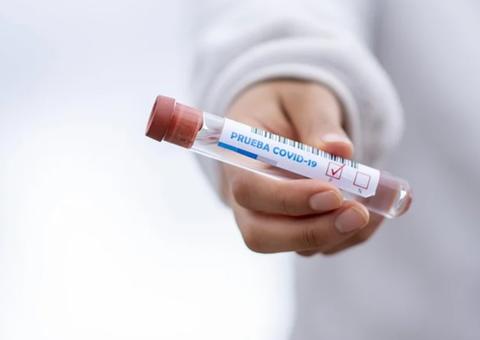 Estudo mostra que novo coronavírus consegue infectar neurônios humanos