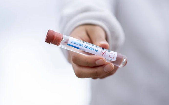 Estudo mostra que novo coronavírus consegue infectar neurônios humanos