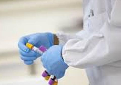 Policiais de Tabatinga fazem teste de covid-19 e recebem higienização nas viaturas 