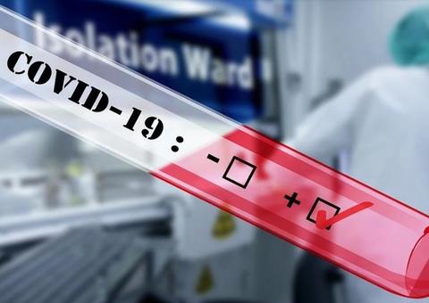 Brasil atinge mais de 90 mil casos confirmados de Covid-19 