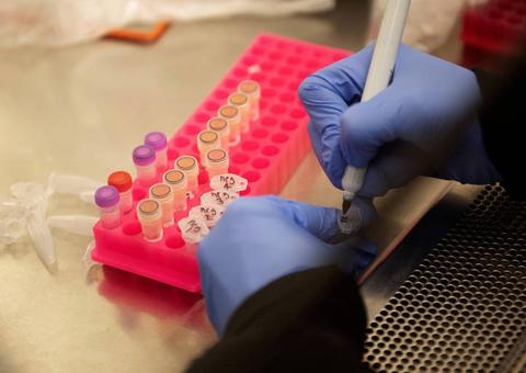 Cloroquina é droga mais testada no mundo contra Covid-19