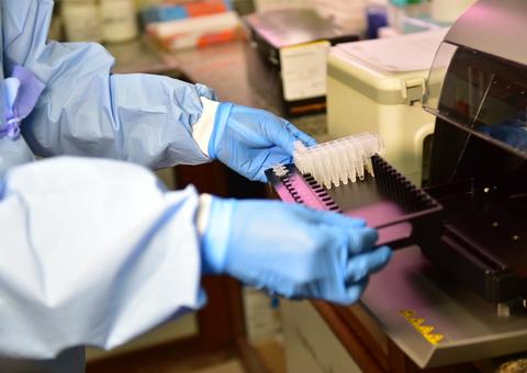 Mais exames e testes refletem em explosão dos casos de Covid-19 no Amazonas