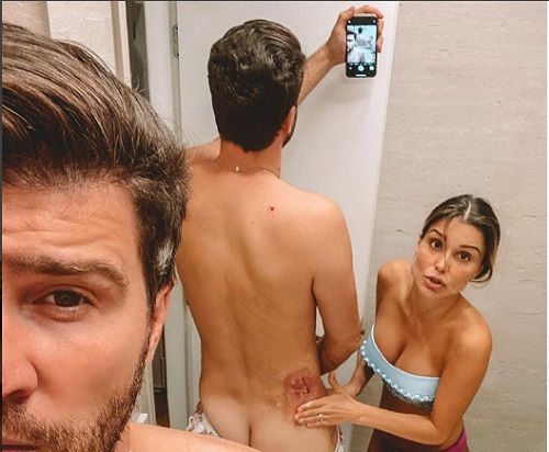 Marcelo Zangrandi posa pelado sob cuidados da esposa Flávia Viana