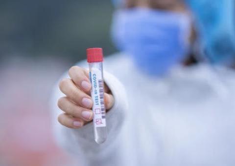 Amazonas atinge 10 mil infectados pelo novo coronavírus 