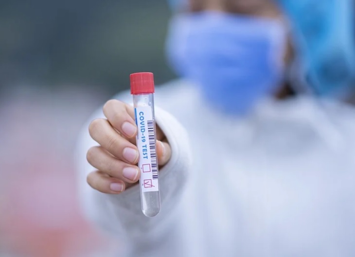 Amazonas atinge 10 mil infectados pelo novo coronavírus 