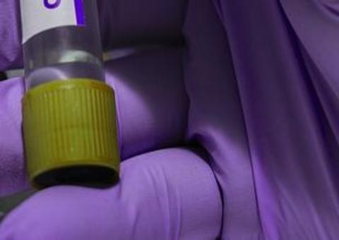 Interior do Amazonas registra 5.401 casos de Covid-19 em 55 municípios 