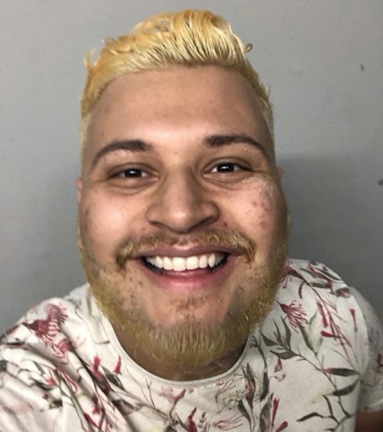 Ex-BBB Victor Hugo muda visual e choca seguidores 