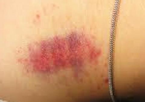 Mulher chega em casa com 'chupão' no pescoço, chama marido de corno e é agredida