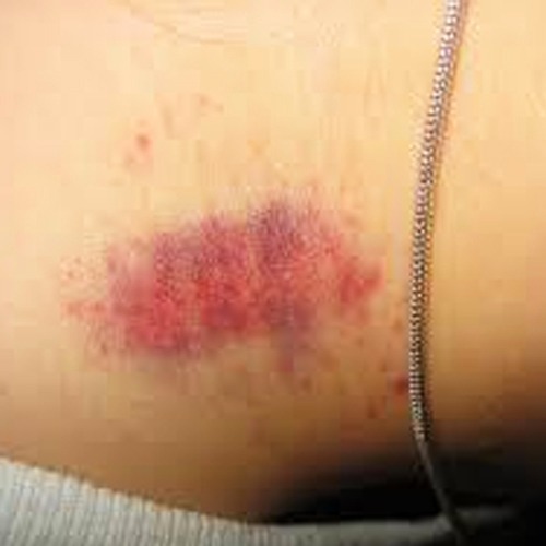 Mulher chega em casa com 'chupão' no pescoço, chama marido de corno e é agredida