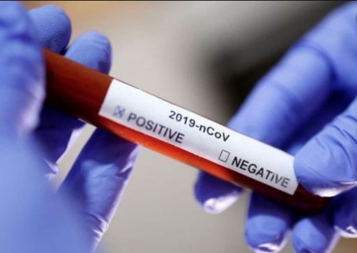 Brasil sobe para 7º posição no ranking de países com mais casos de coronavírus no mundo