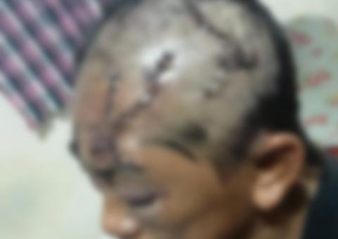 Mulher tem rosto desfigurado após ser atacada por ex-genro em Manaus