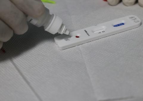FVS divulga regras para farmácias e drogarias aplicarem testes rápidos da Covid-19 no Amazonas