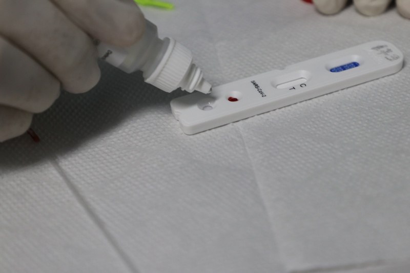 FVS divulga regras para farmácias e drogarias aplicarem testes rápidos da Covid-19 no Amazonas