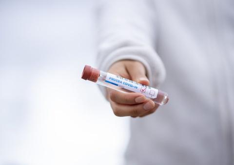 Japão começa a fornecer antiviral recém-aprovado para tratar coronavírus