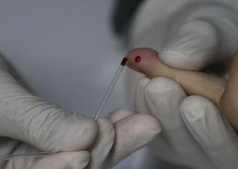 Ministério Público vai fiscalizar farmácias que oferecem testes rápidos da Covid-19 em Manaus