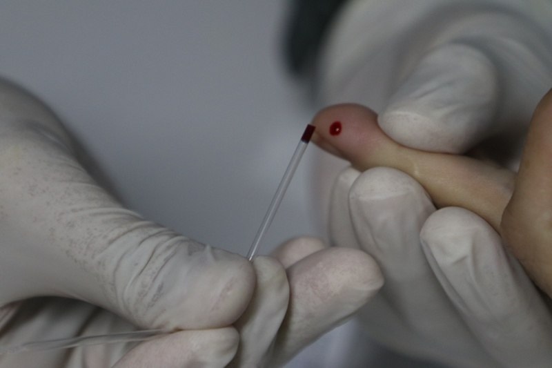 Ministério Público vai fiscalizar farmácias que oferecem testes rápidos da Covid-19 em Manaus