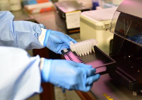 Amazonas vai receber 5 mil testes para diagnóstico da Covid-19 comprados pela Petrobras