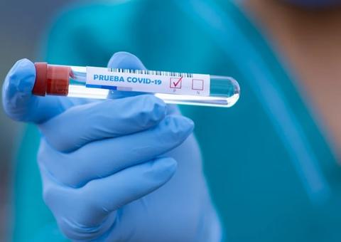 Interior do Amazonas se aproxima dos 9 mil casos de Covid-19 