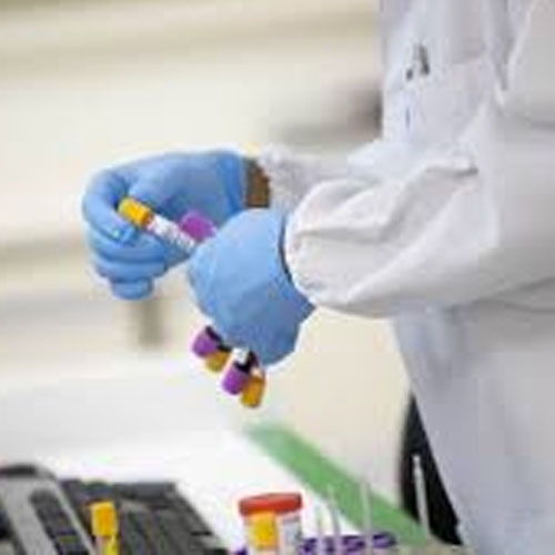 Número de recuperados de Covid-19 no Amazonas ultrapassa 10 mil,  segundo FVS