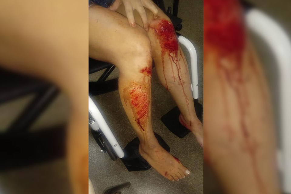 Jovem pula de carro em movimento para fugir de estupro: ‘Deus me deu forças’  