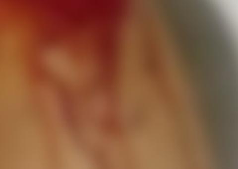 Jovem pula de carro em movimento para fugir de estupro: ‘Deus me deu forças’  