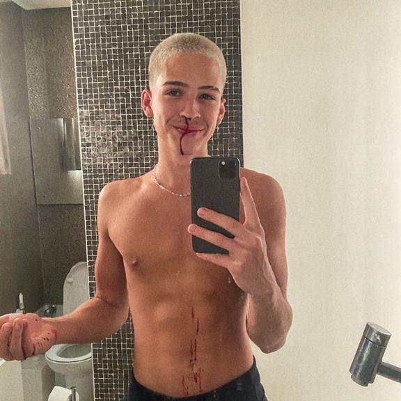 Filho de Leonardo, João Guilherme, surge ensanguentado e preocupa fãs 